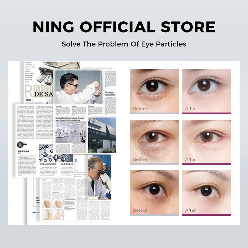 Eye Serum for Dark Circles, Puffiness & Fine Lines – Firming & Hydrating Eye Essence with Retinol & Caffeine