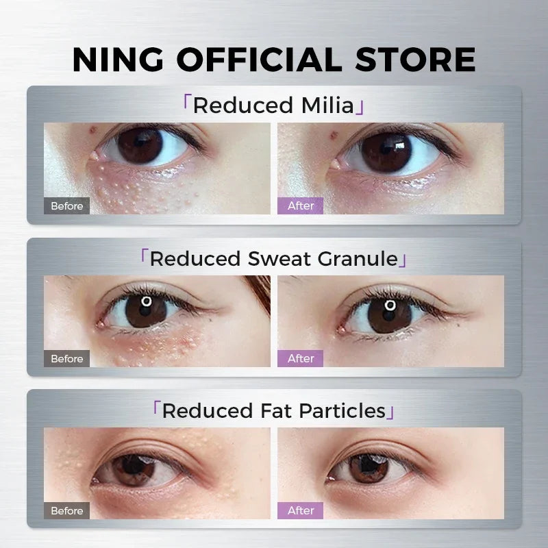 Eye Serum for Dark Circles, Puffiness & Fine Lines – Firming & Hydrating Eye Essence with Retinol & Caffeine