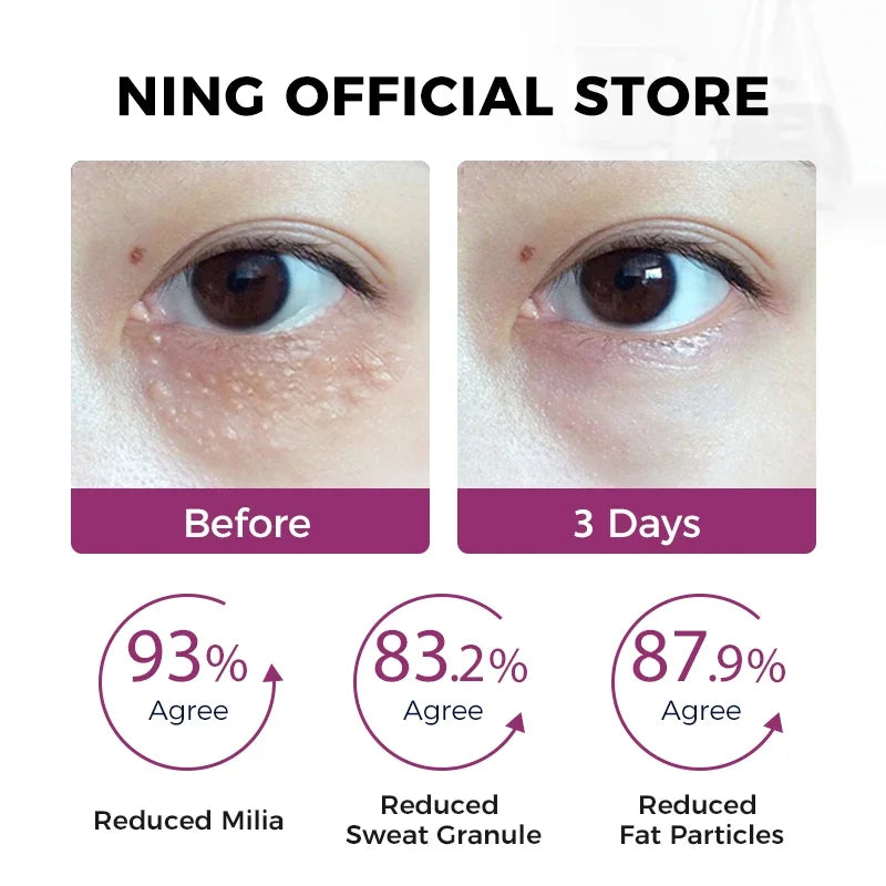 Eye Serum for Dark Circles, Puffiness & Fine Lines – Firming & Hydrating Eye Essence with Retinol & Caffeine